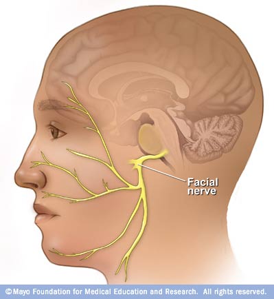Cranial Facial Disorders 111